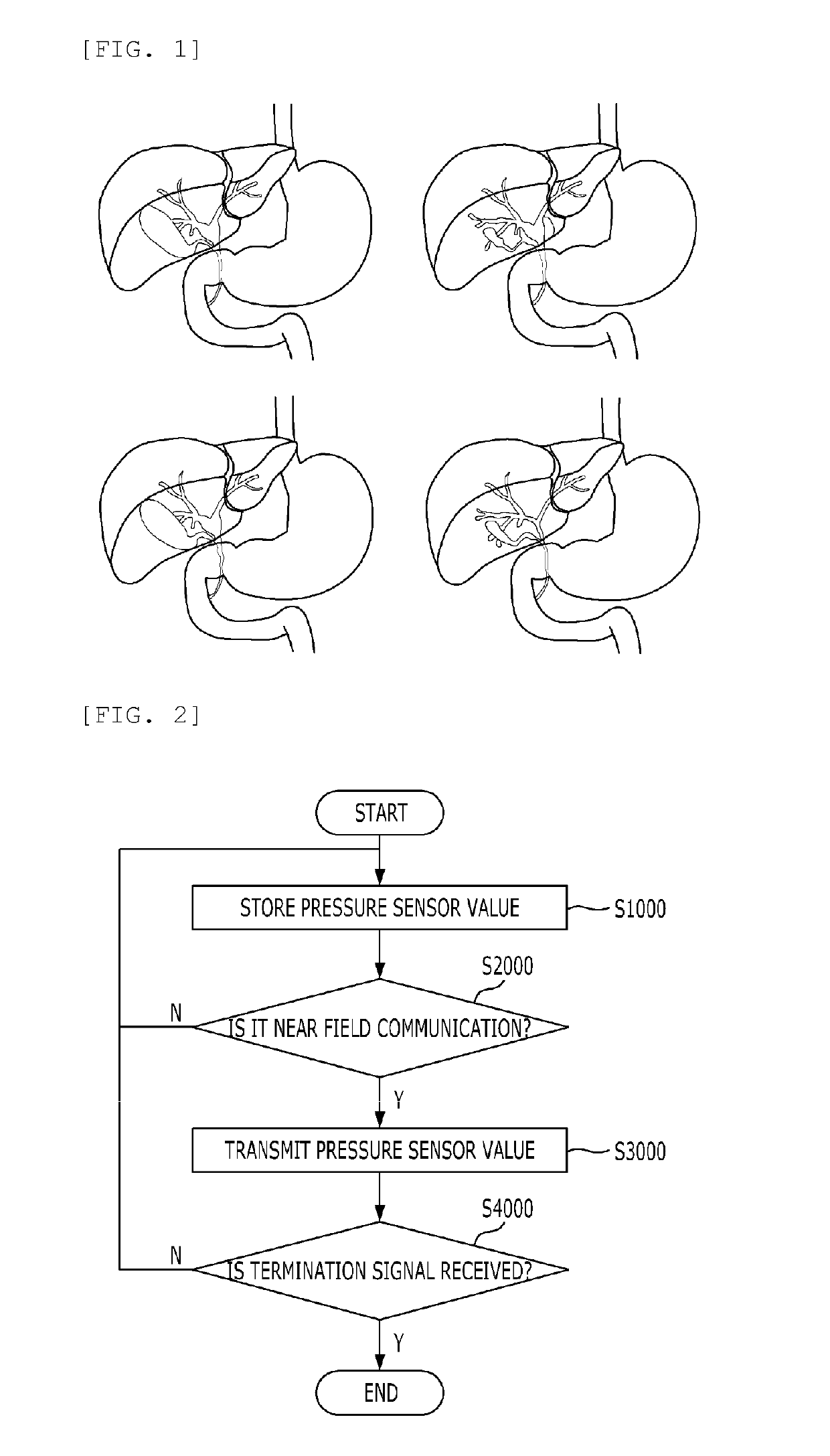 System and method for monitoring biliary obstruction