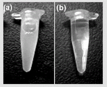 Contrast medium based on iopamidol lipid derivative as well as preparation method and application of contrast medium