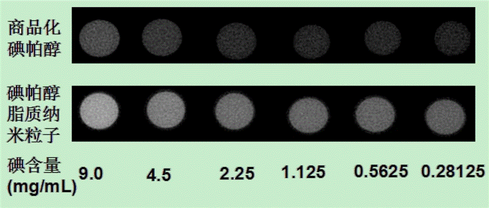 Contrast medium based on iopamidol lipid derivative as well as preparation method and application of contrast medium