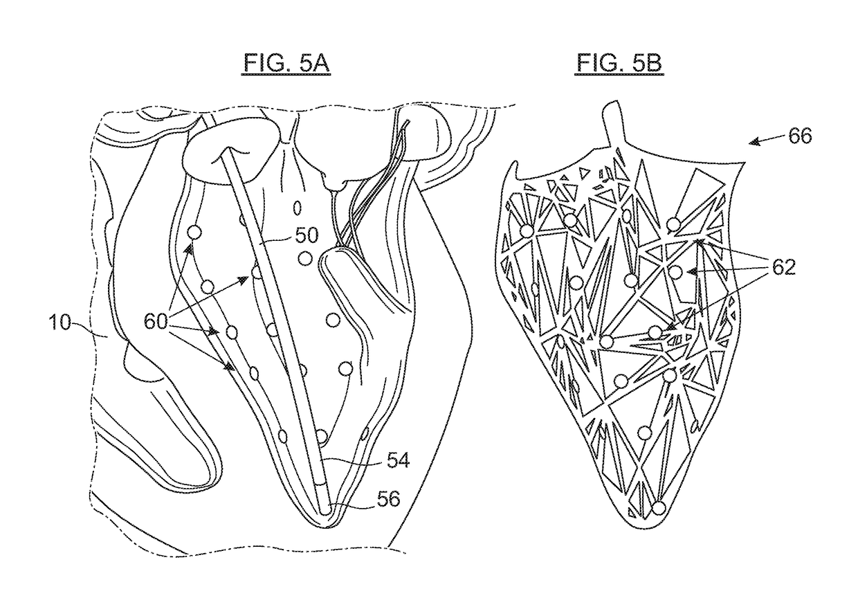 Cardiac mapping and navigation for transcatheter procedures