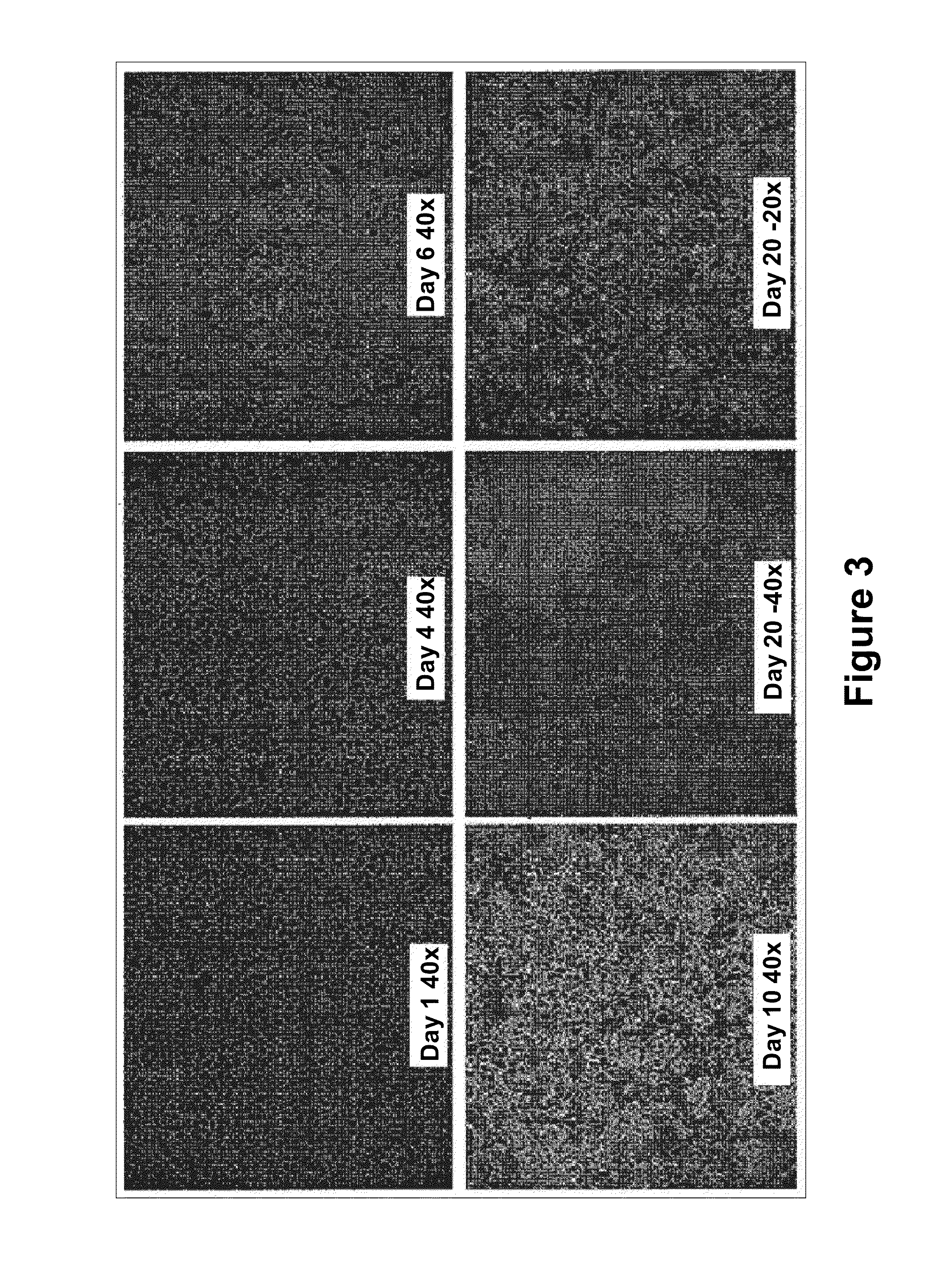 Optimized Methods for Differentiation of Cells Into Cells with Hepatocyte and Hepatocyte Progenitor Phenotypes, Cells Produced by the Methods, and Methods for Using the Cells