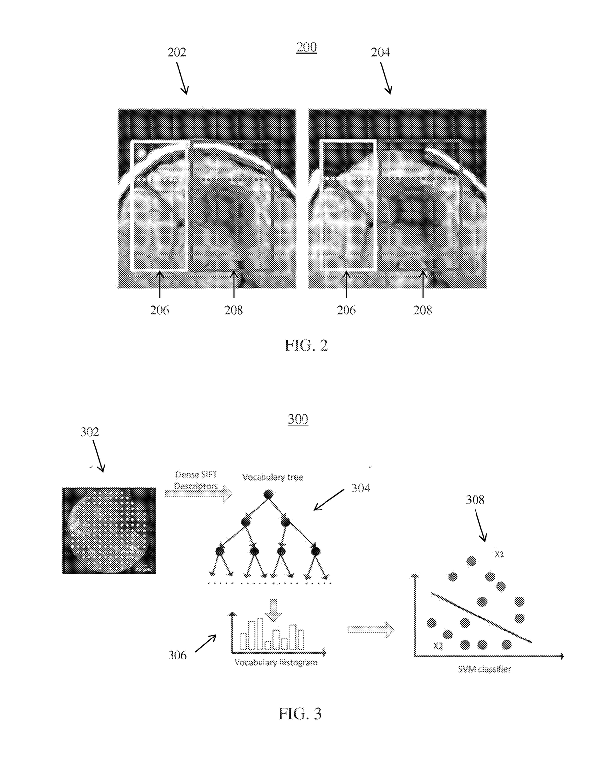 A system and method for surgical guidance and intra-operative pathology through endo-microscopic tissue differentiation