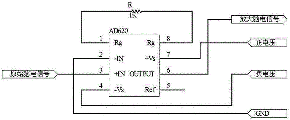 Dry electrode system for detecting electroencephalogram