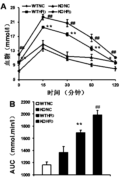 Functions and use of zinc finger protein A20 in treating fatty liver and type 2 diabetes mellitus
