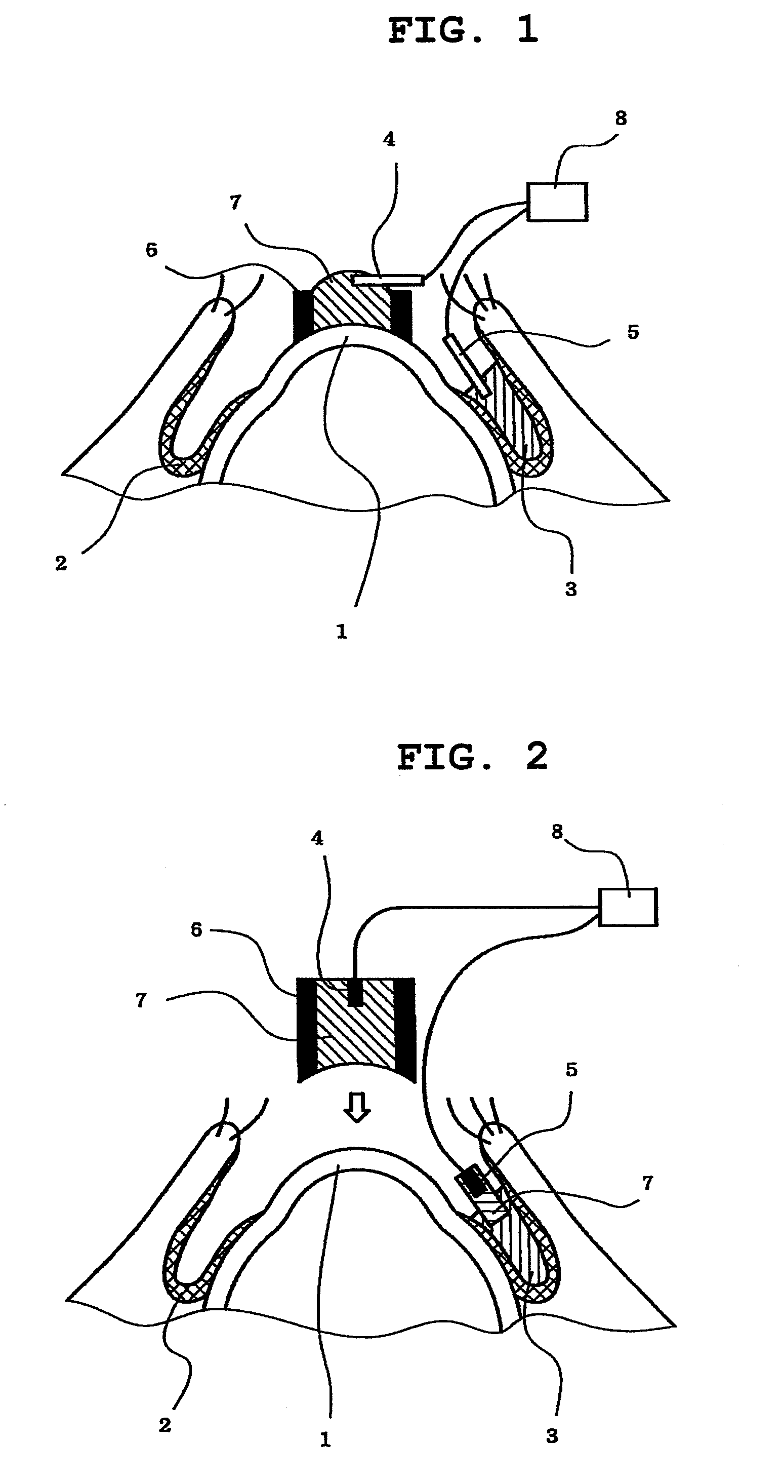 Method of measuring electrical resistance value of corneal trans-epithelium