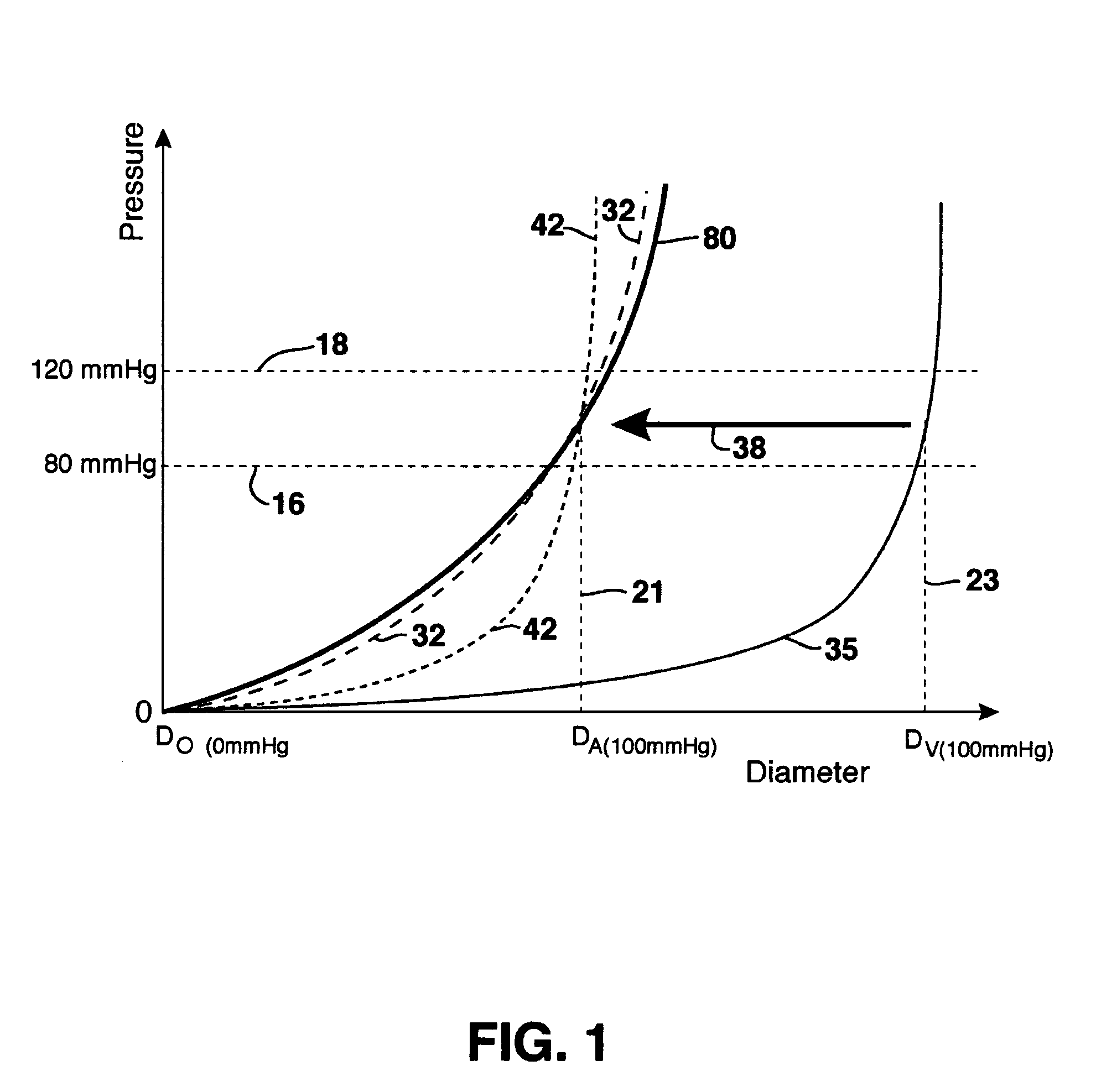 Compliant venous graft