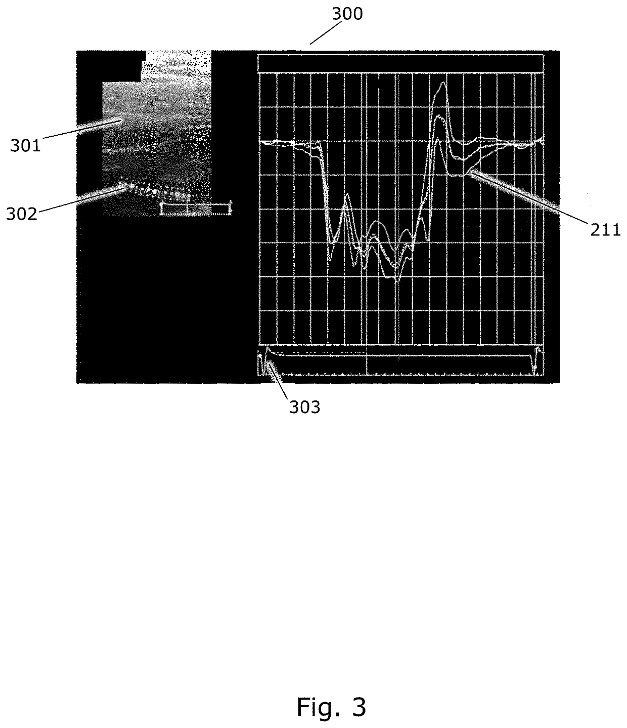 Ultrasonographic method for measuring muscle deformation