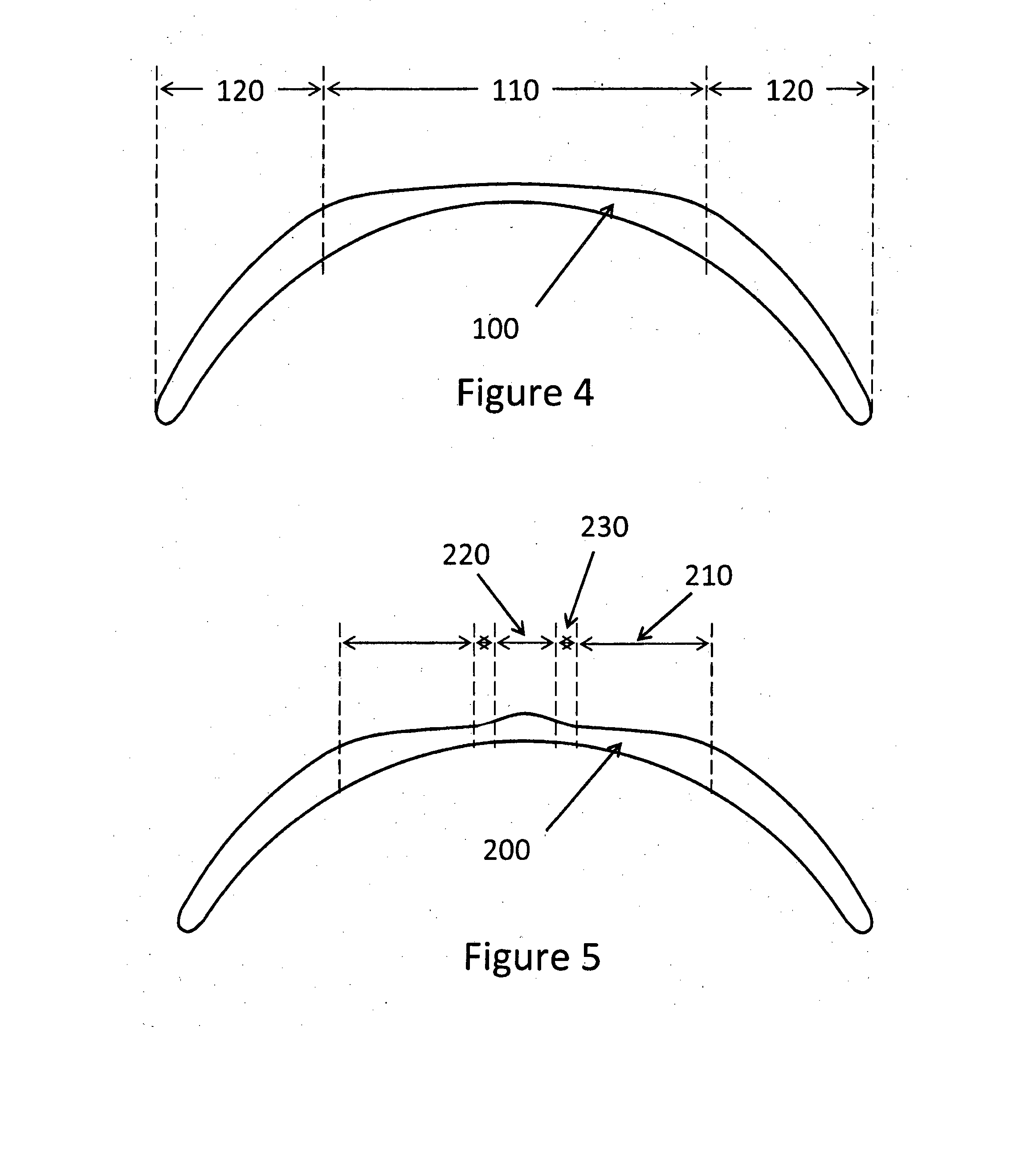 Corneal remodelling contact lenses and methods of treating refractive error using corneal remodelling