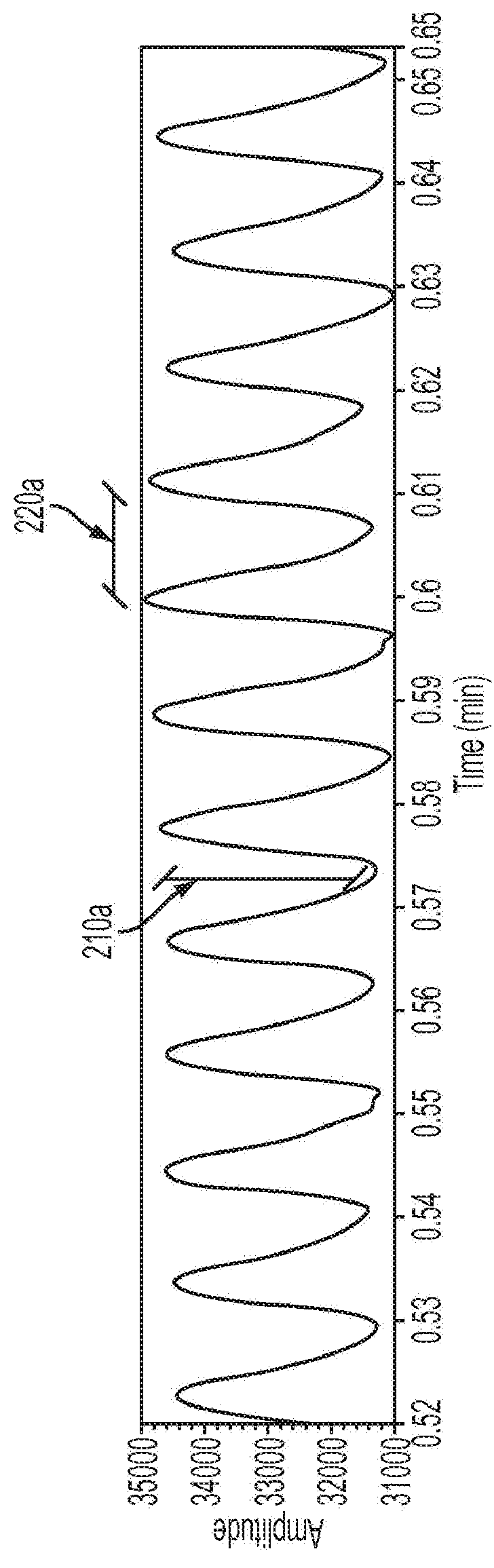 Methods And Systems For Predicting Hypovolemic Hypotensive Conditions Resulting From Bradycardia Behavior Using A Pulse Volume Waveform
