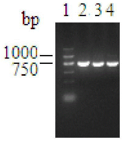 A carbonyl reductase gene, encoding enzyme, carrier, engineering bacteria and application thereof