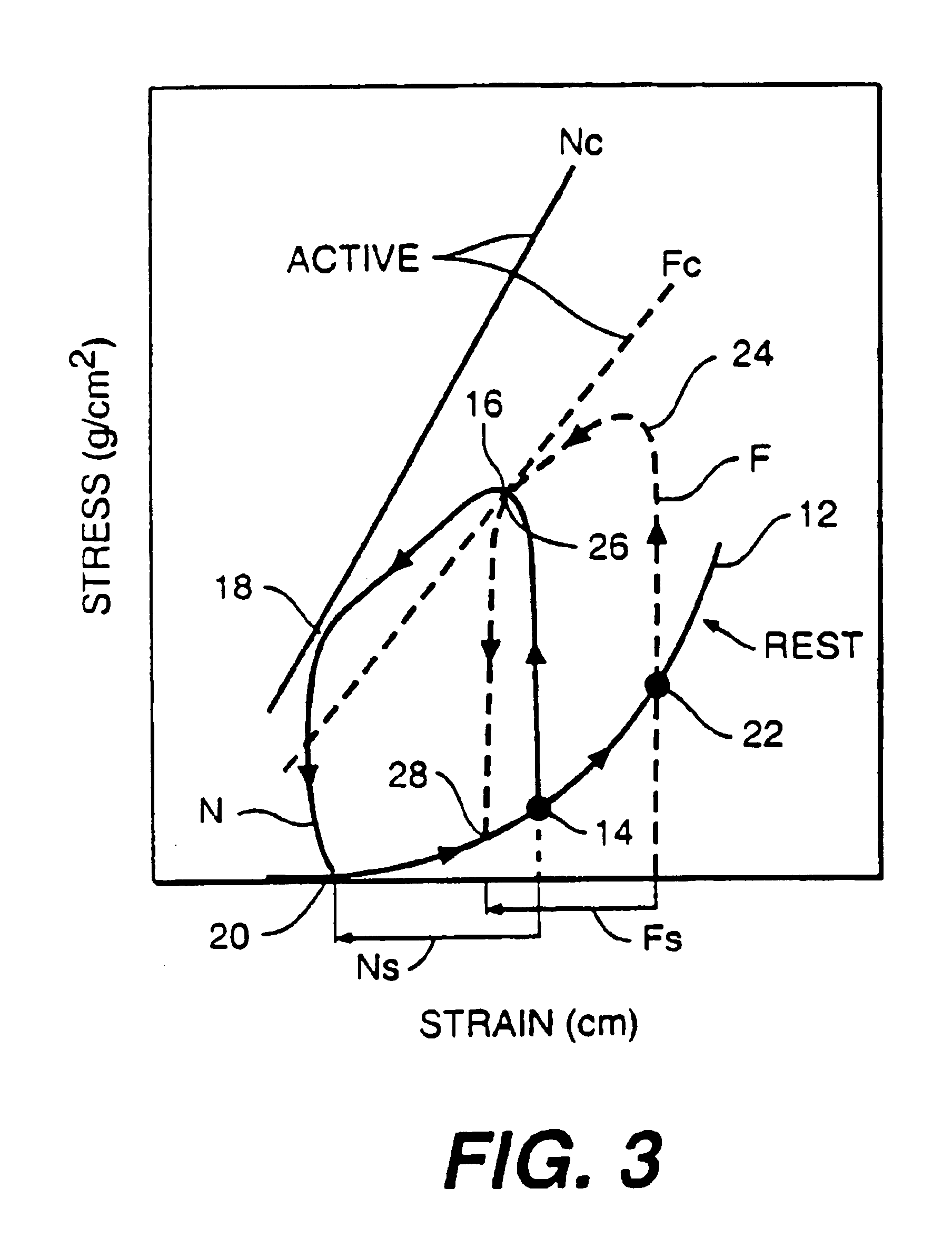 Stress reduction apparatus and method
