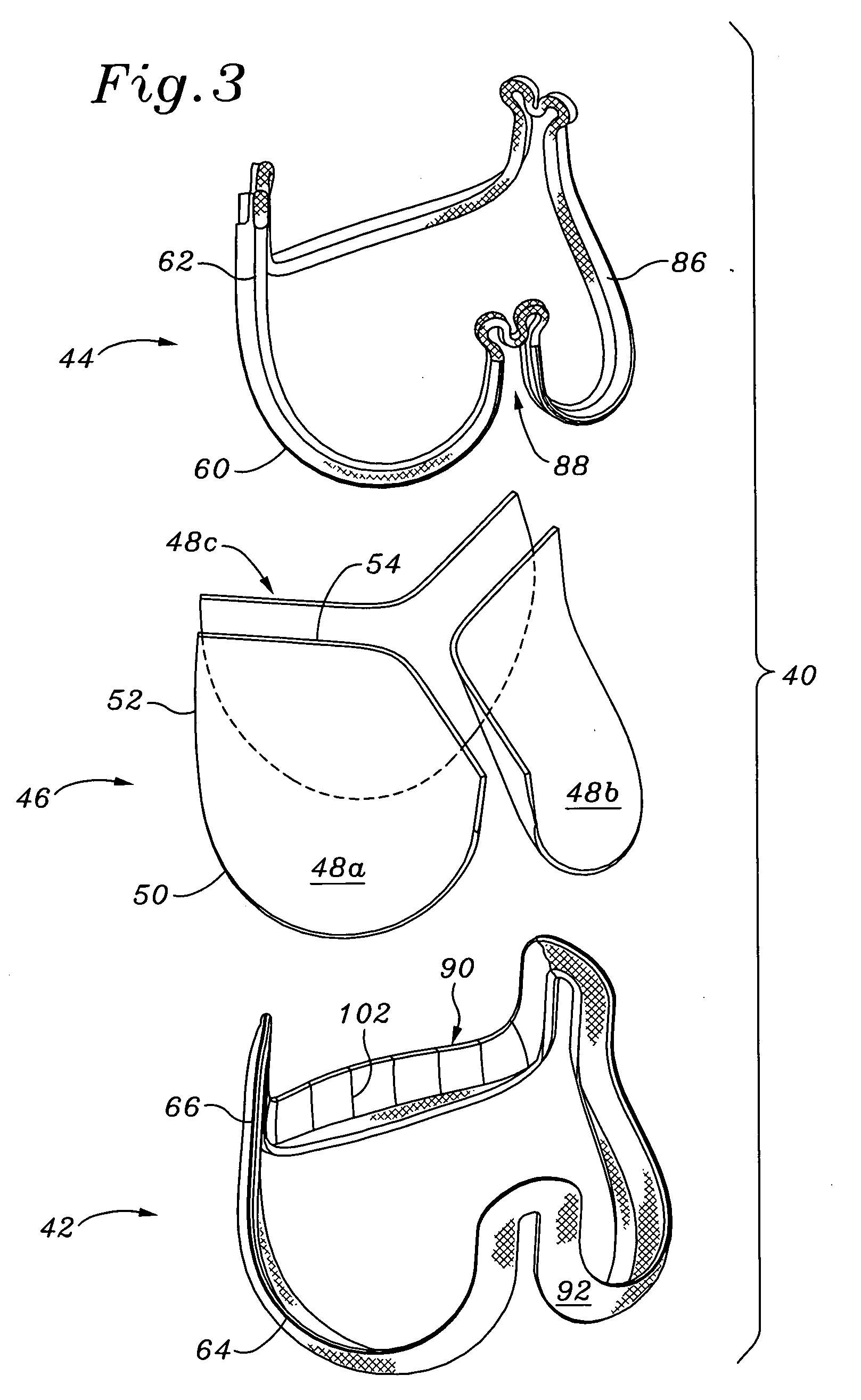 Highly flexible heart valve connecting band