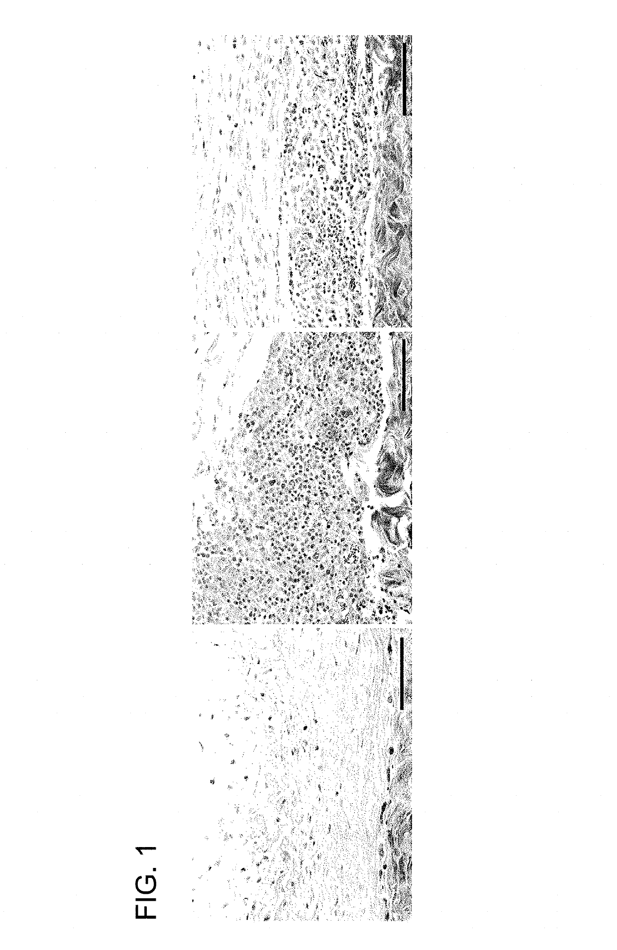 Methods for tissue passivation