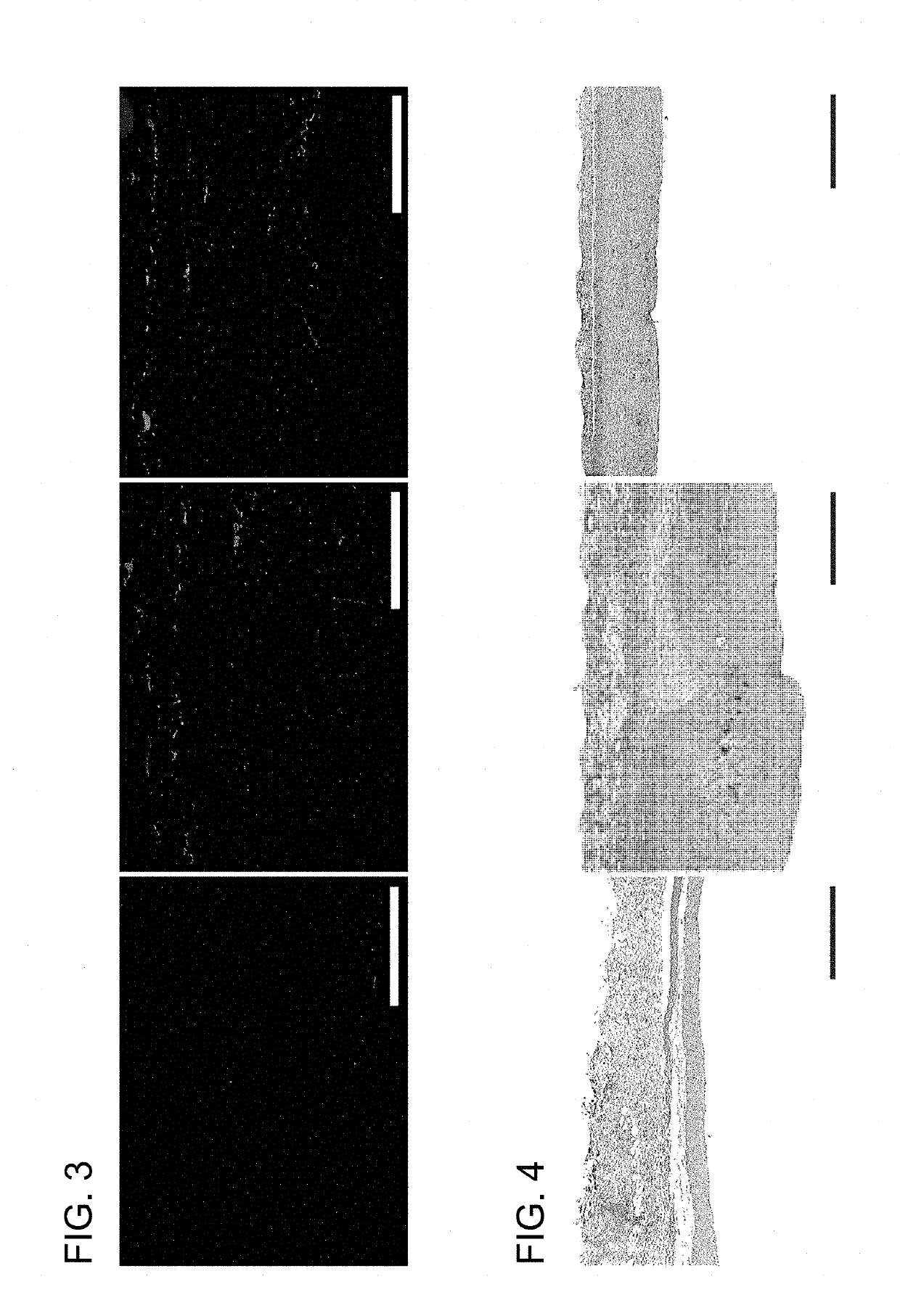 Methods for tissue passivation