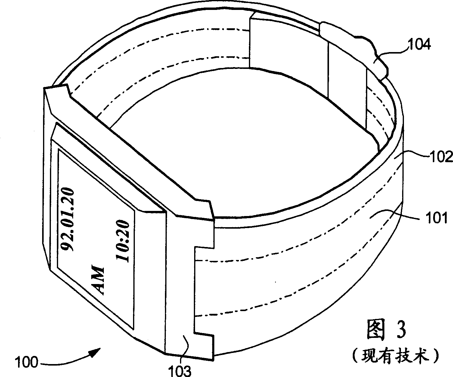 Interconnection circuit between two loop antennas embedded in a wristband of a wrist-carried wireless instrument