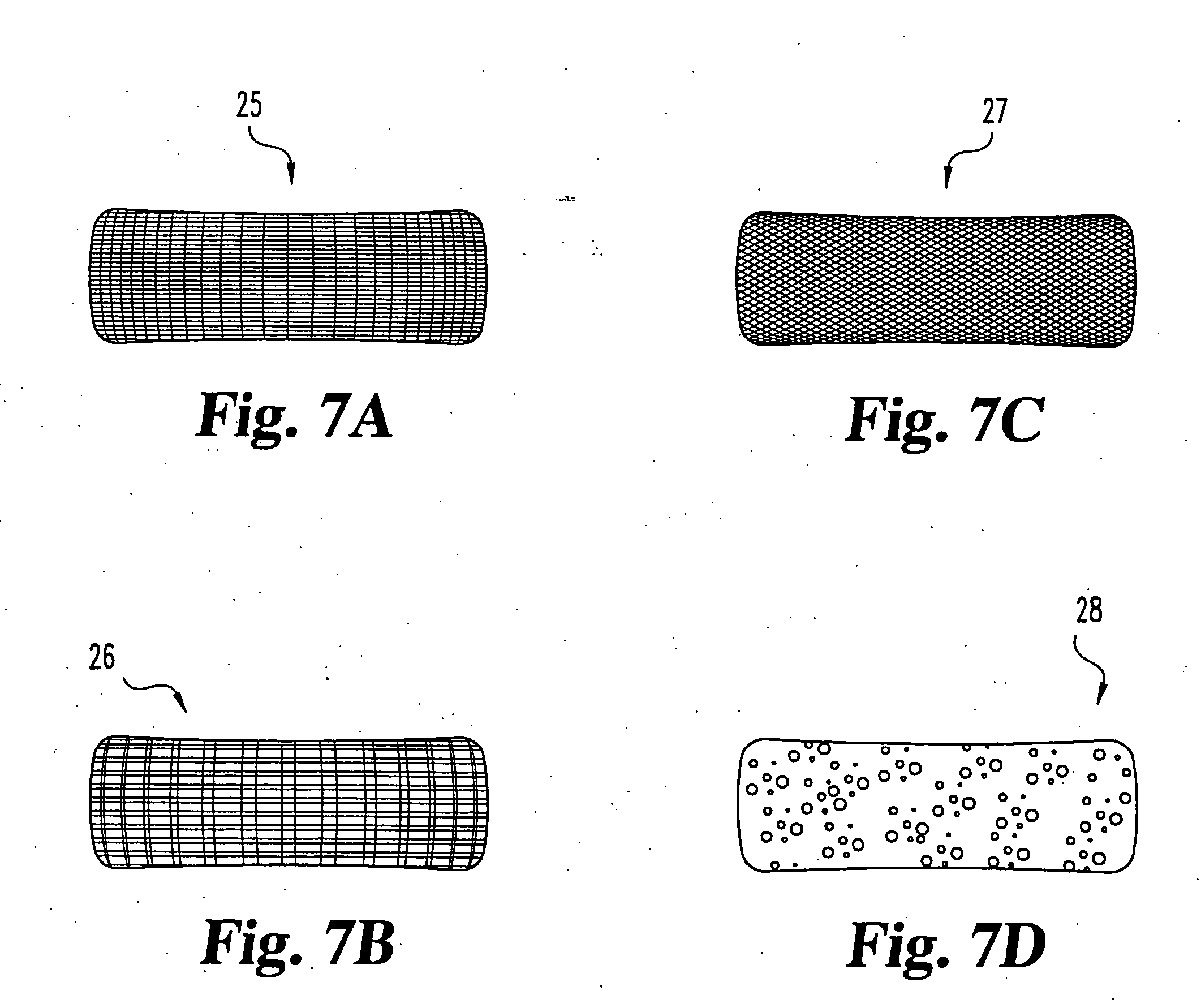 Spinal nucleus replacement implants and methods
