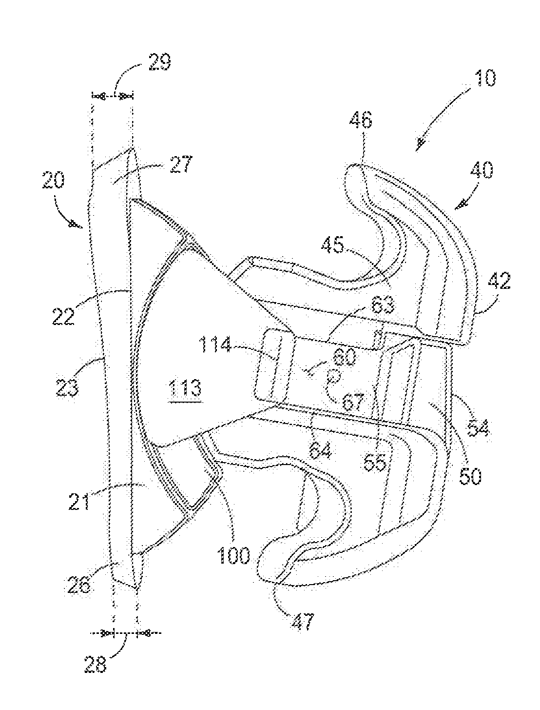 Orthodontic Bracket Apparatus and Method for Treating a Malocclusion