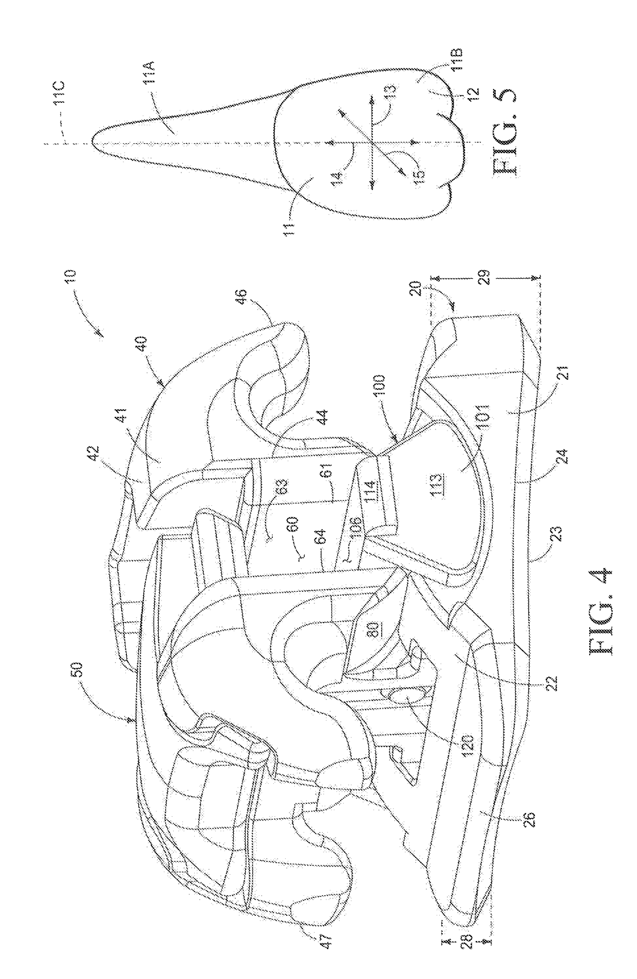 Orthodontic Bracket Apparatus and Method for Treating a Malocclusion