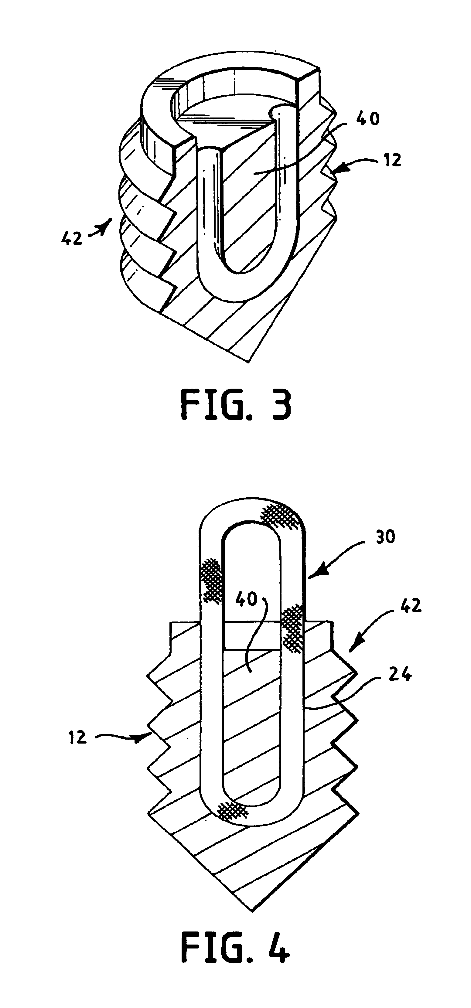 Apparatus and method for securing suture to bone