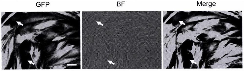 Method for preparing dopaminergic neurons reserving age characteristics through non-nerve cell transformation