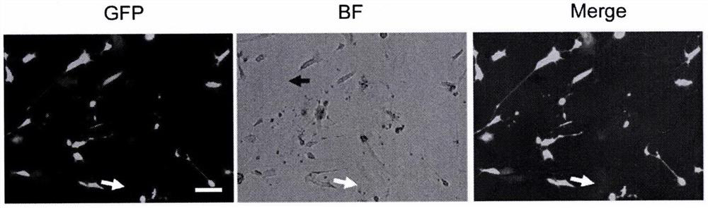 Method for preparing dopaminergic neurons reserving age characteristics through non-nerve cell transformation