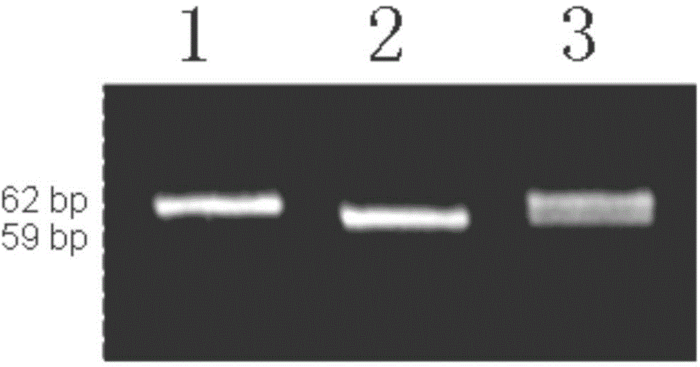 Molecular marker of rice amylose content micro-control gene SSIVb and application thereof