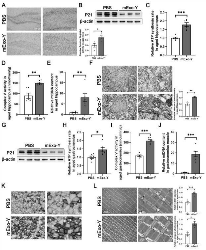 Application of young blood plasma exosome in preparation of medicine for treating senescence-induced degenerative diseases