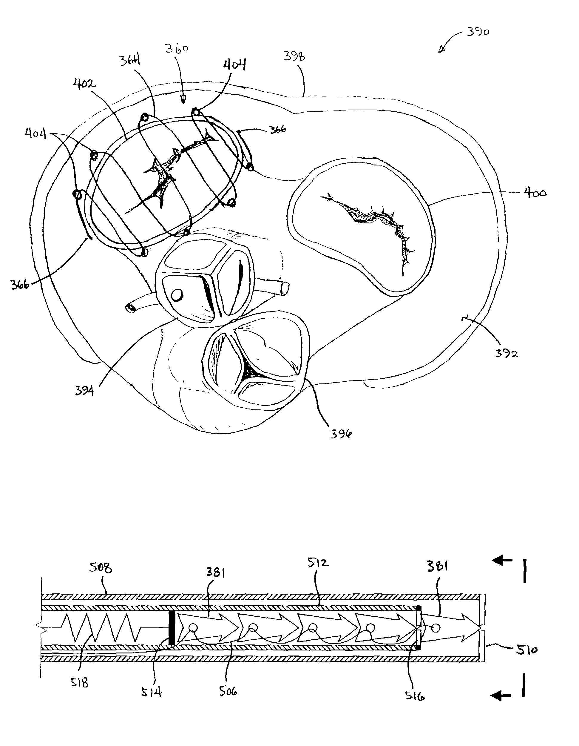 Apparatus and methods for treating tissue