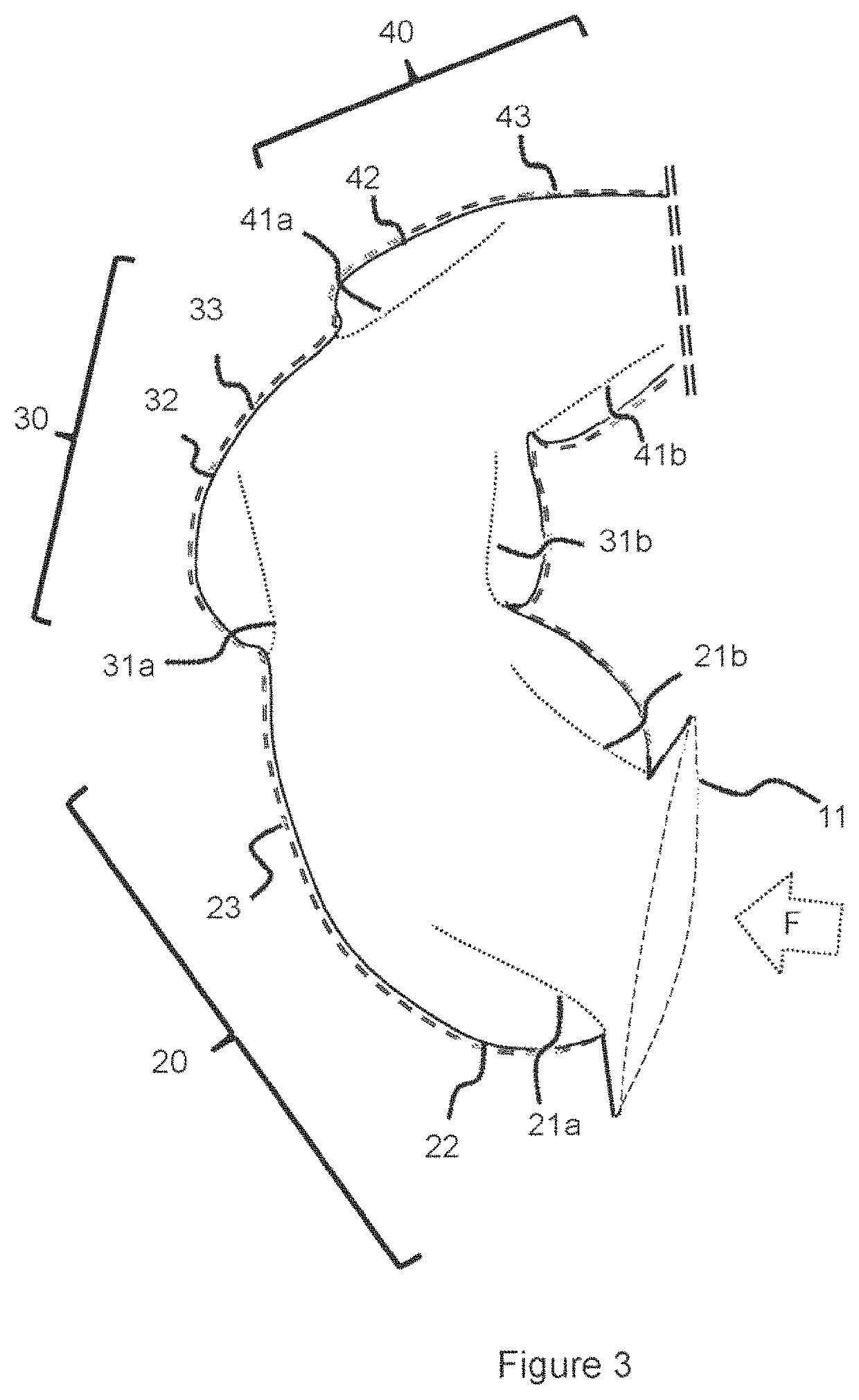 Wave energy capture system