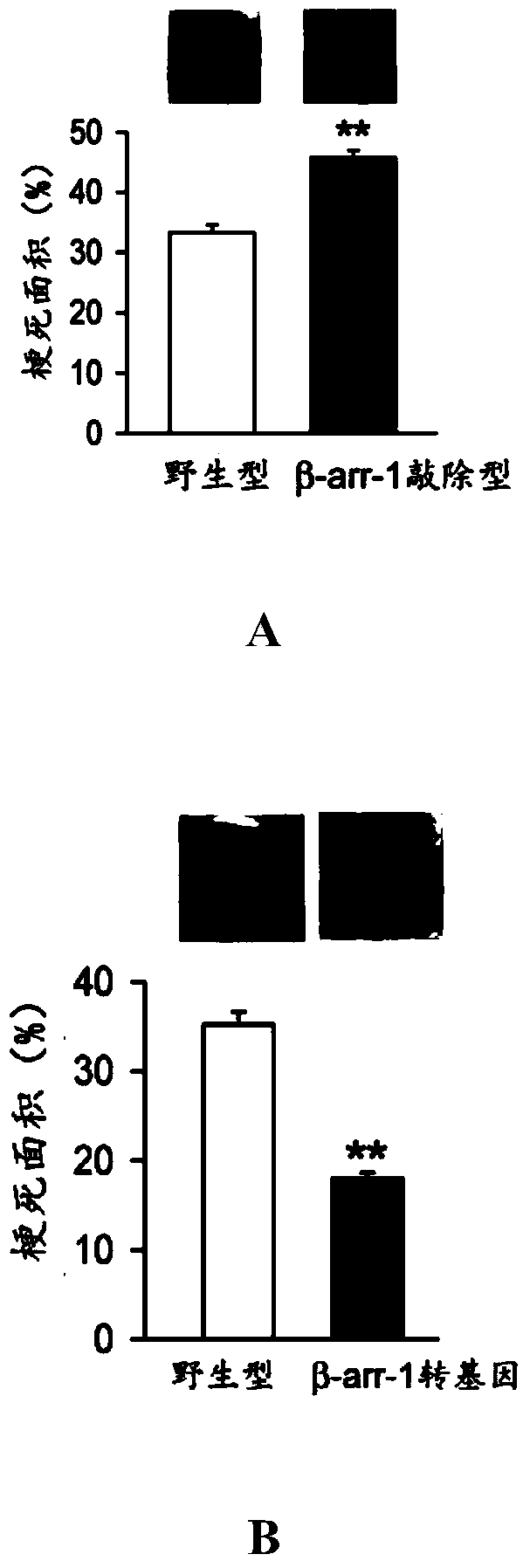 Application of beta-arrestin-1 in preparing medicine for preventing or treating myocardial infarction