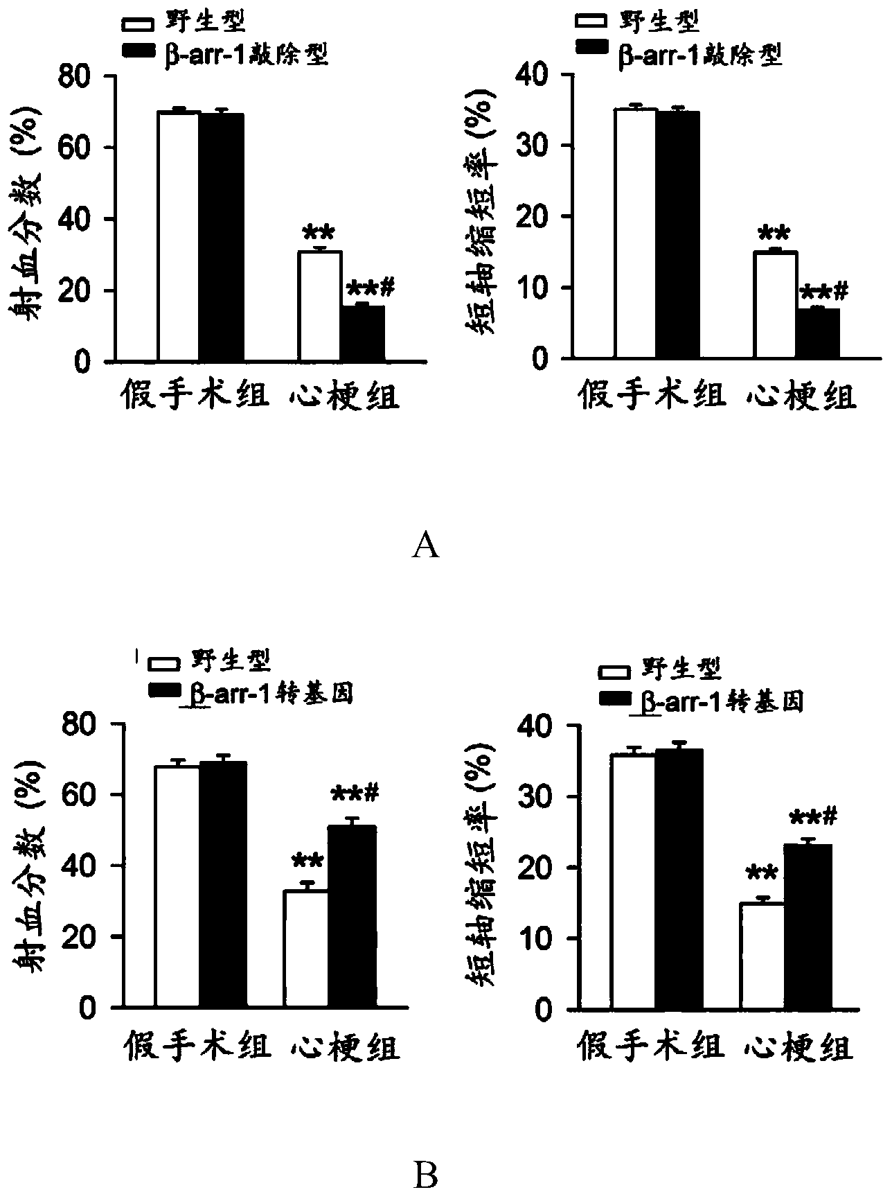 Application of beta-arrestin-1 in preparing medicine for preventing or treating myocardial infarction