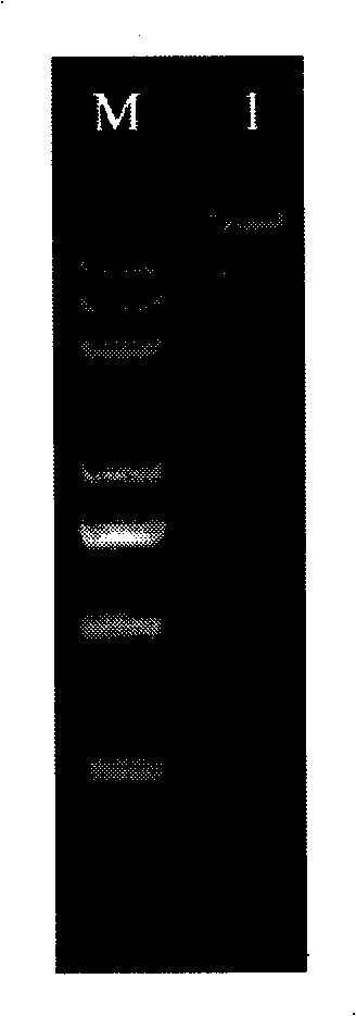 Streptomyces strain and application thereof