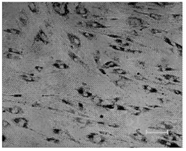 Method for preparing retinal pigment epithelia by utilizing human marrow mesenchymal stem cells