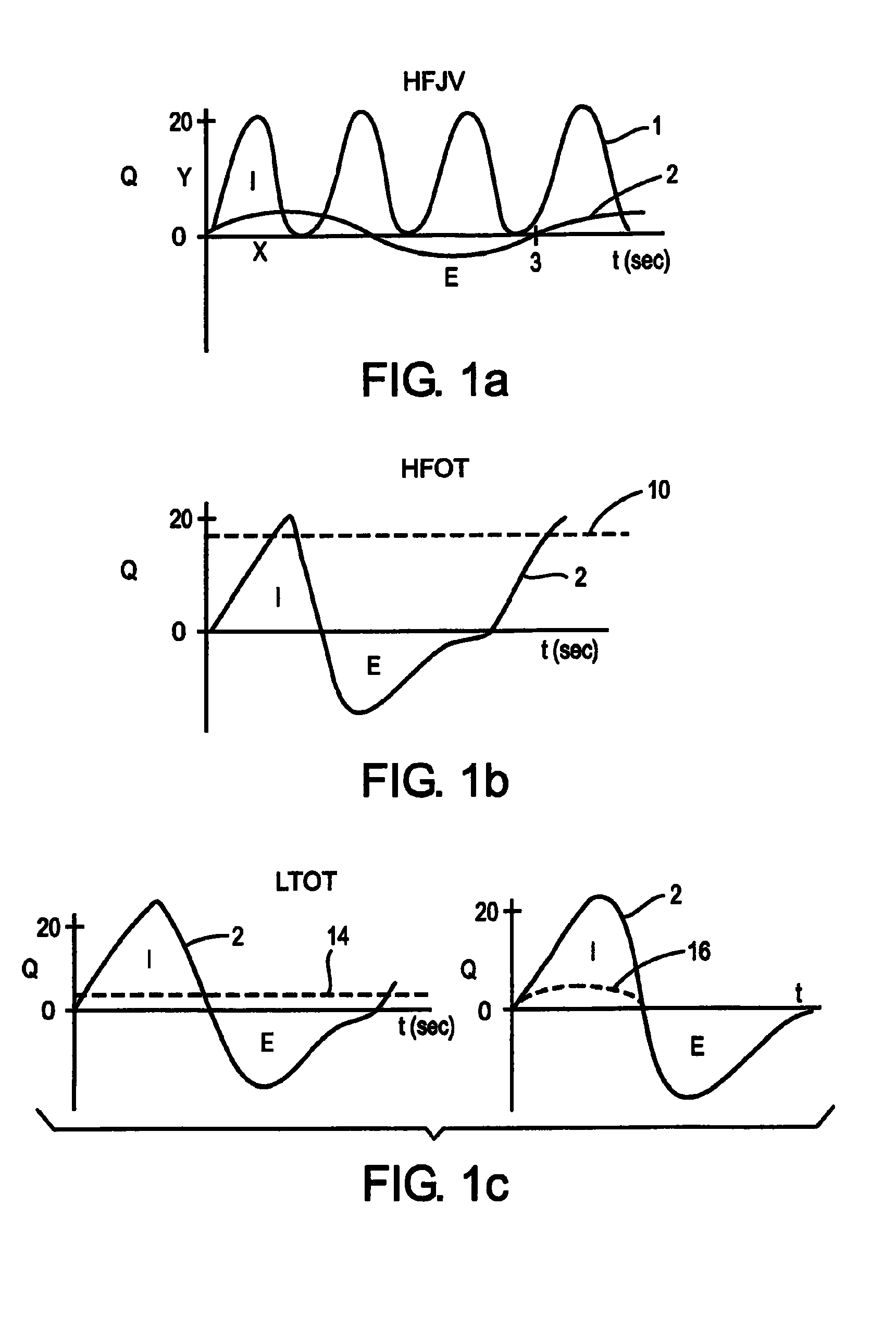 Methods and devices for minimally invasive respiratory support
