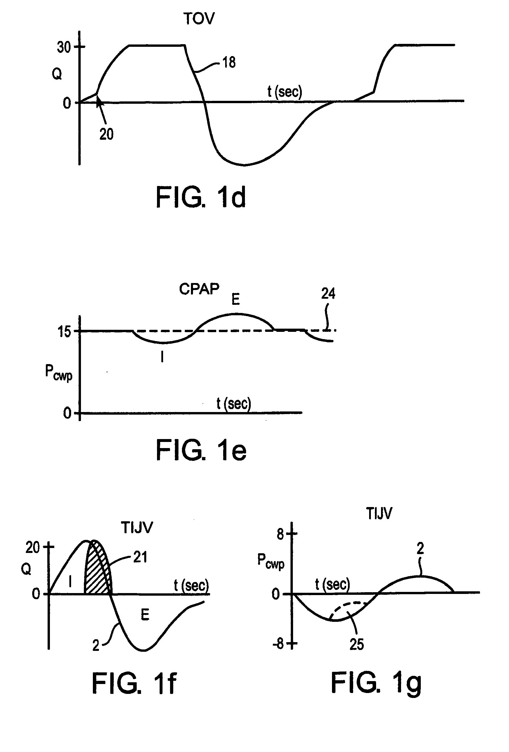 Methods and devices for minimally invasive respiratory support