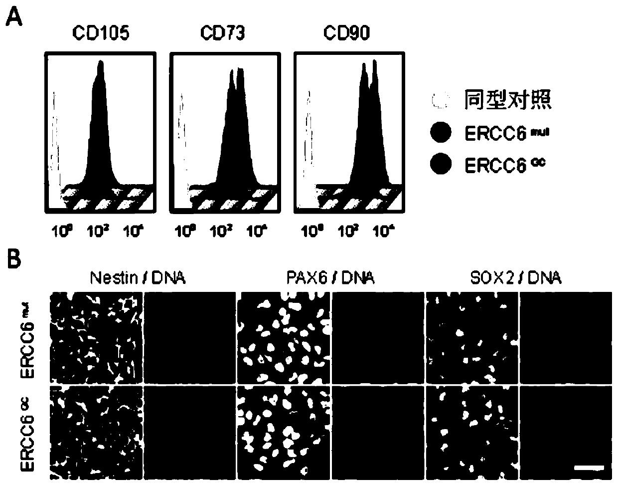 Making method of human cockayne syndrome specificity adult stem cells