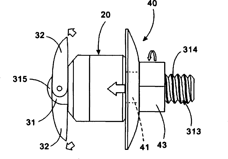 Supporting device of percutaneous expanding crest