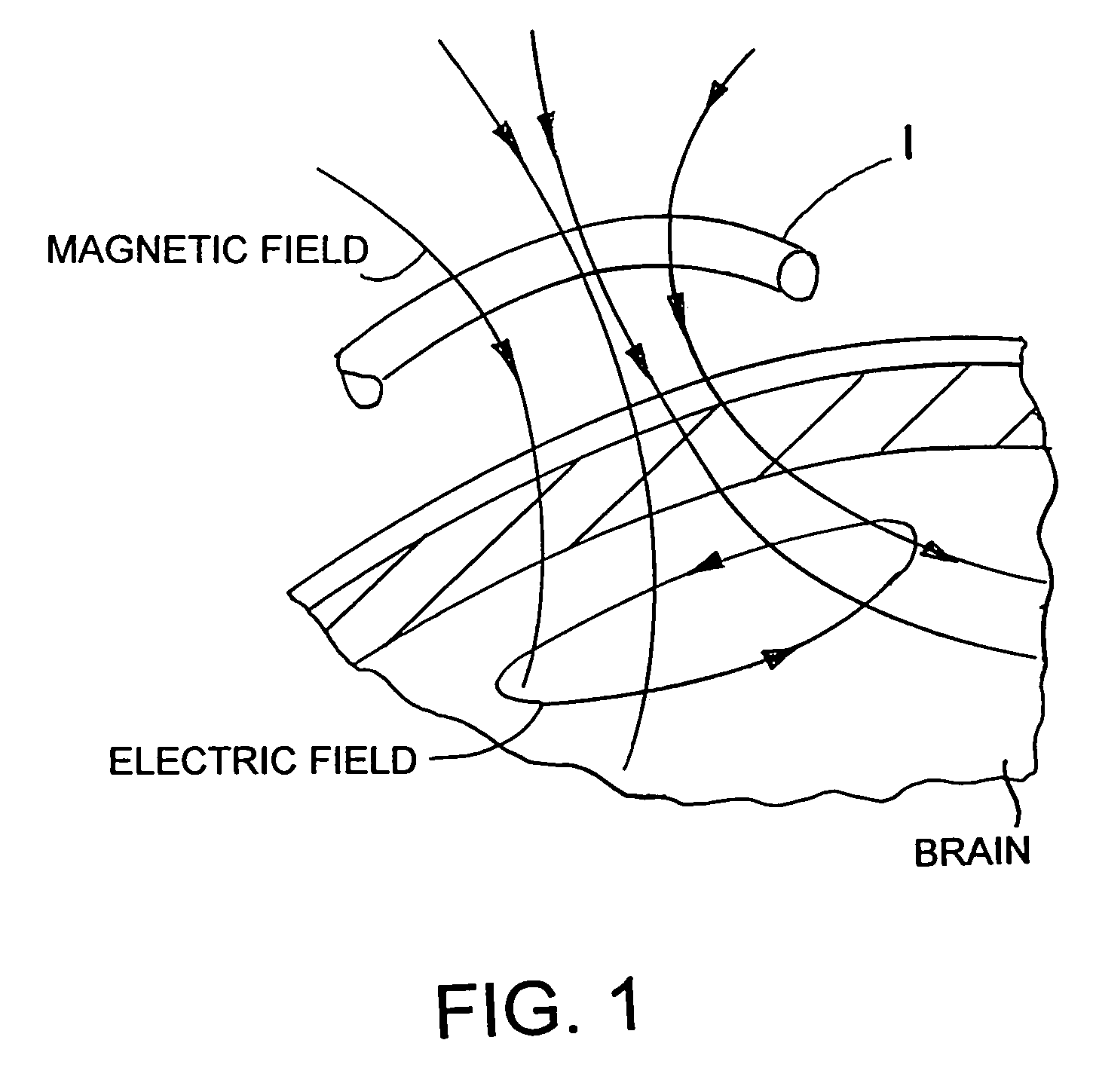 Method and device for transcranial magnetic stimulation