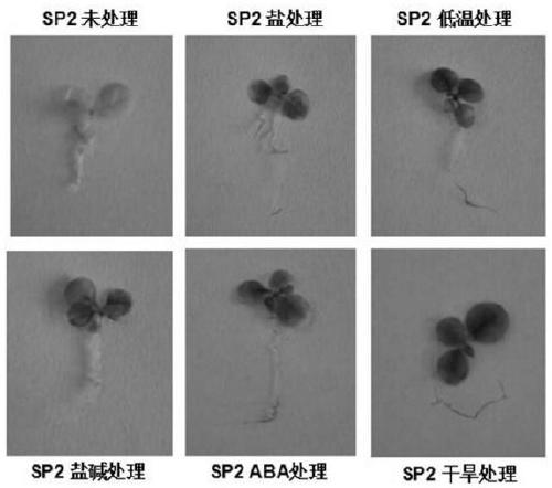 A plant drought-inducible artificially synthesized promoter sp2 and its application