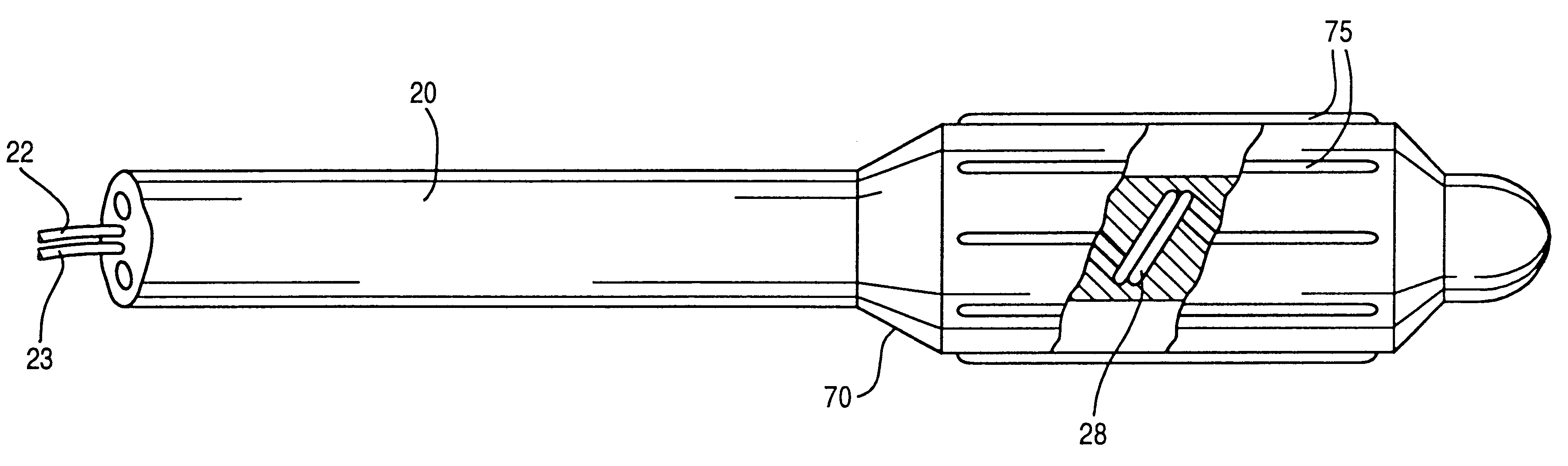 Catheter system for controlling a patient's body temperature by in situ blood temperature modification