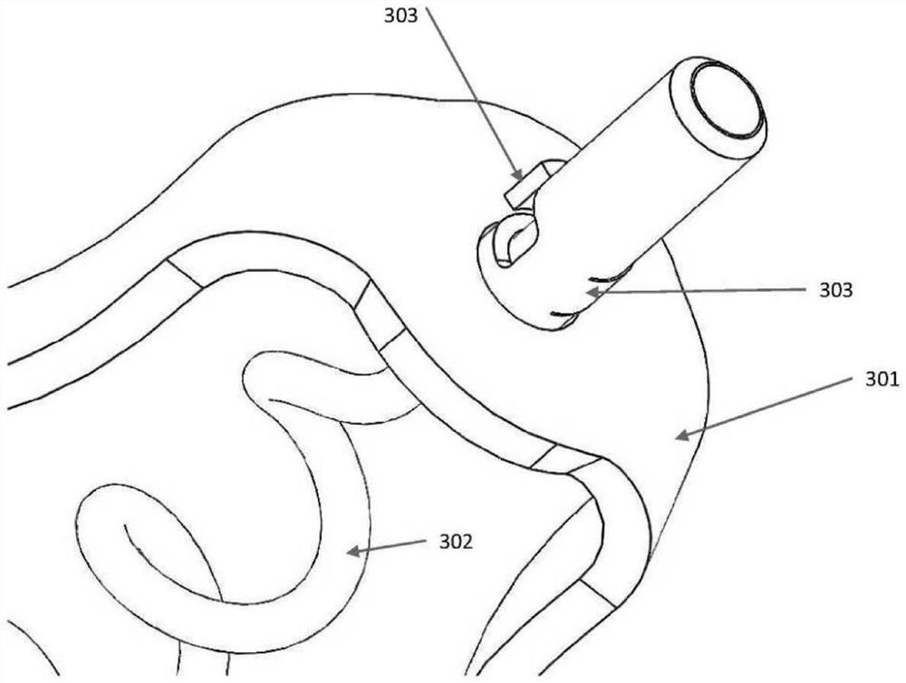 Methods and devices for heart valve repair