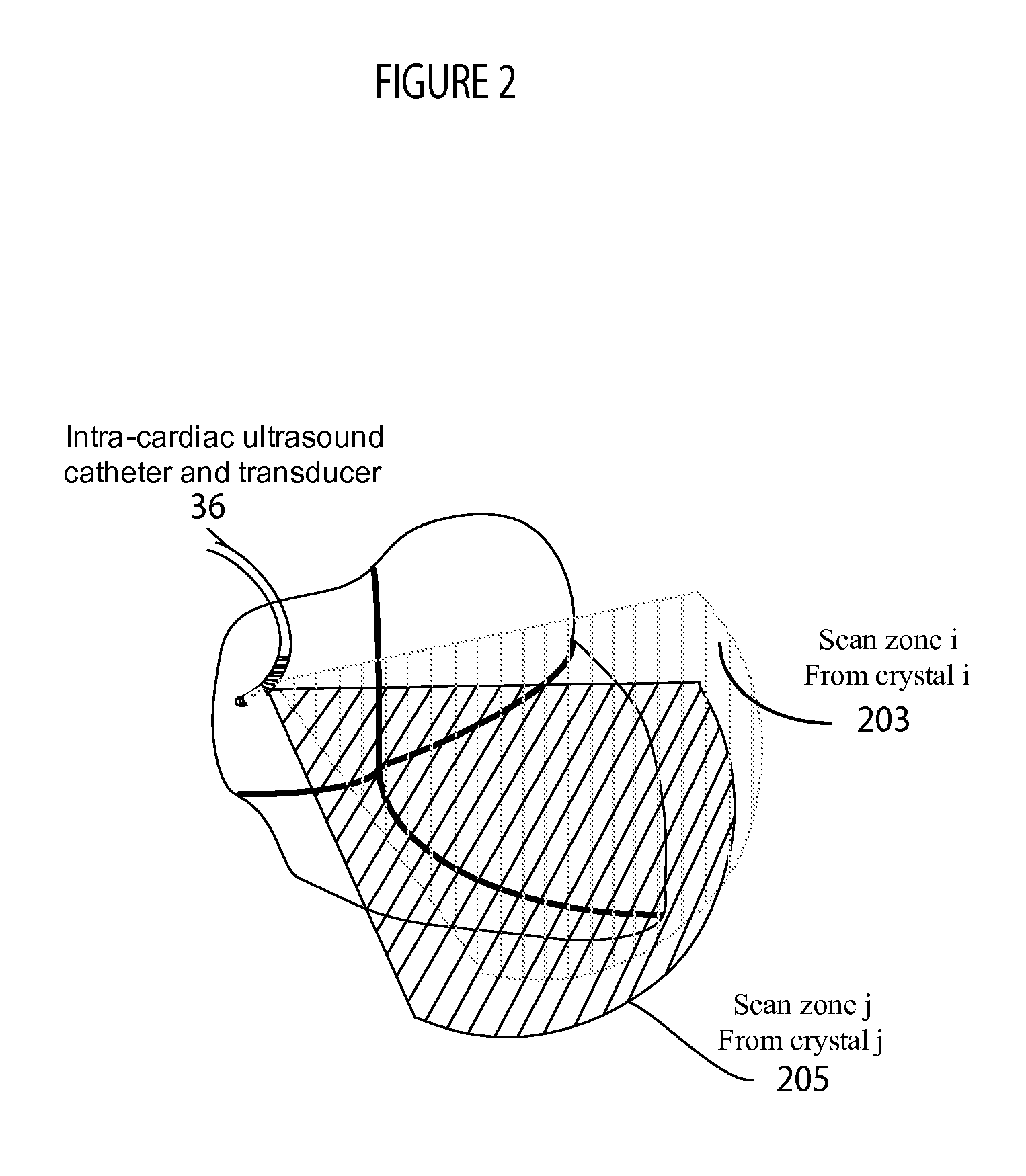 System for Cardiac Ultrasound Image Acquisition