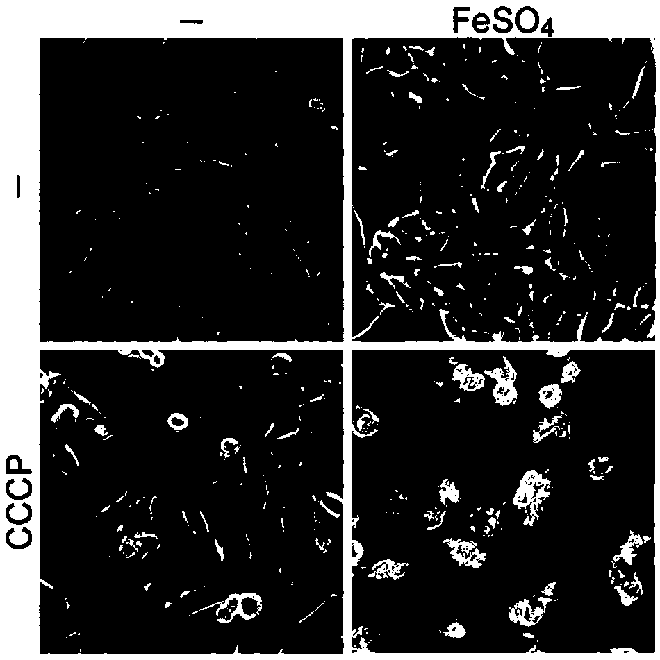 Antitumor drug composition as well as application of reagent comprising iron ions