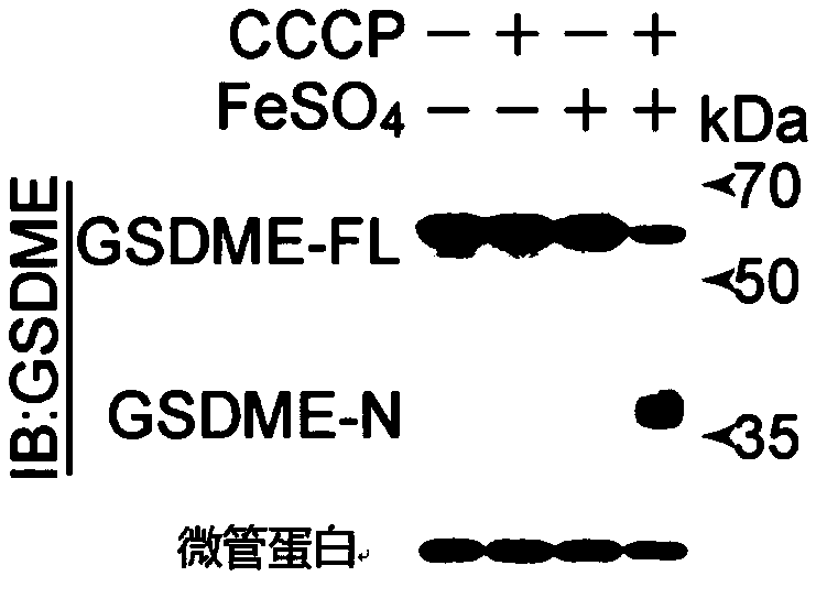 Antitumor drug composition as well as application of reagent comprising iron ions