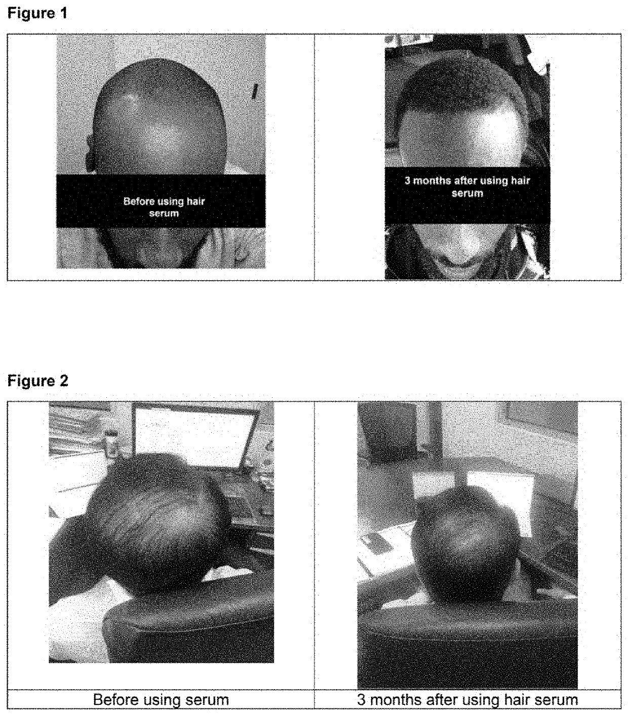 Compositions and methods for reducing hair loss and increasing hair growth