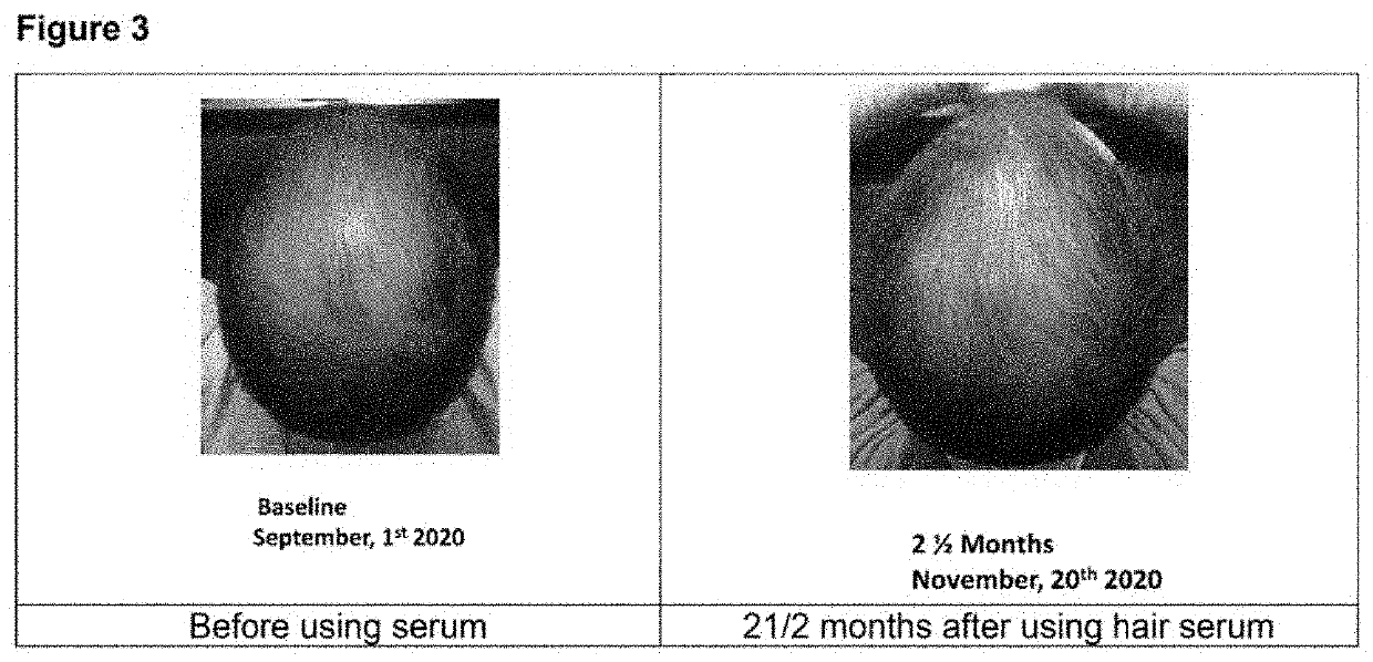 Compositions and methods for reducing hair loss and increasing hair growth