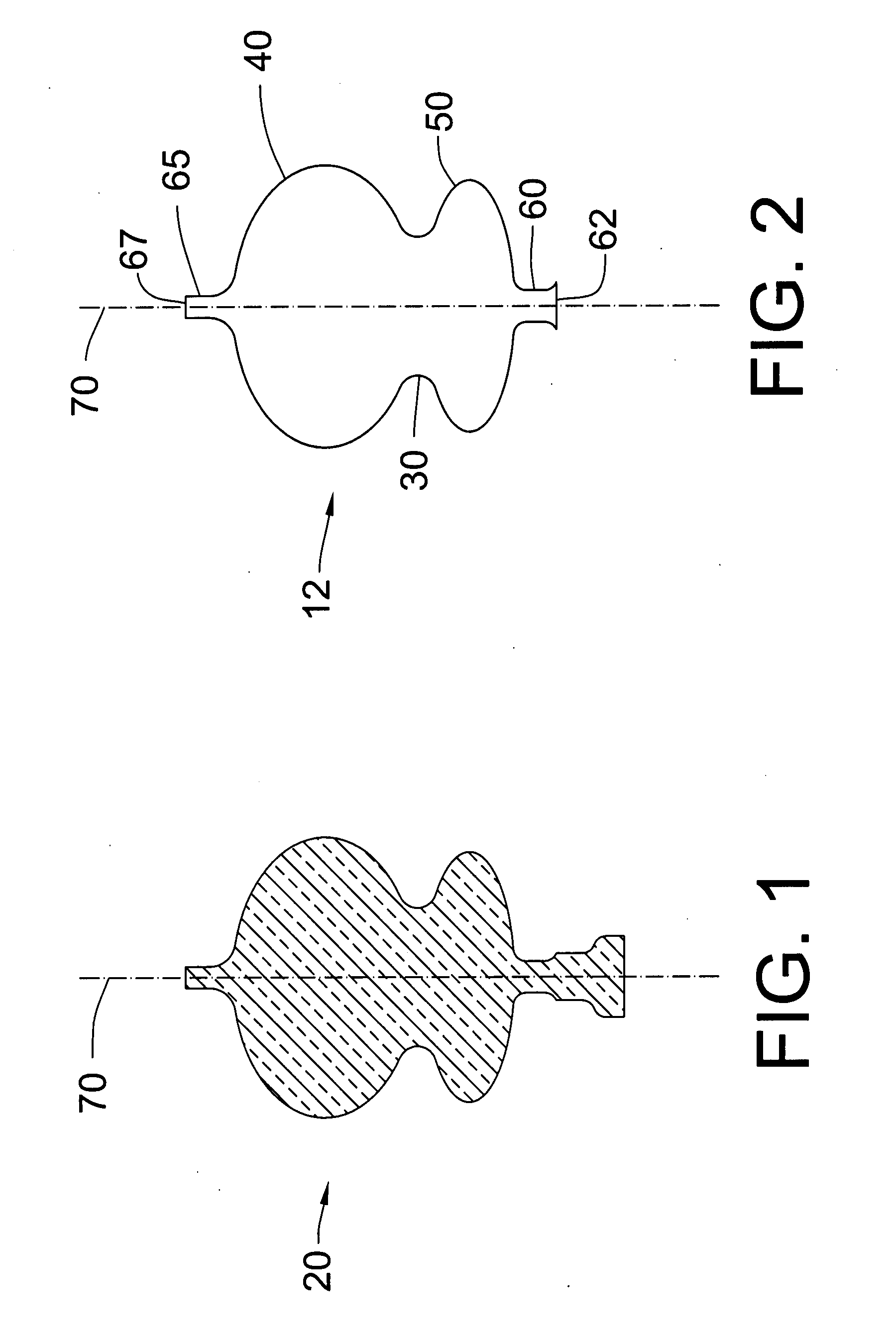 Over-the-wire exclusion device and system for delivery
