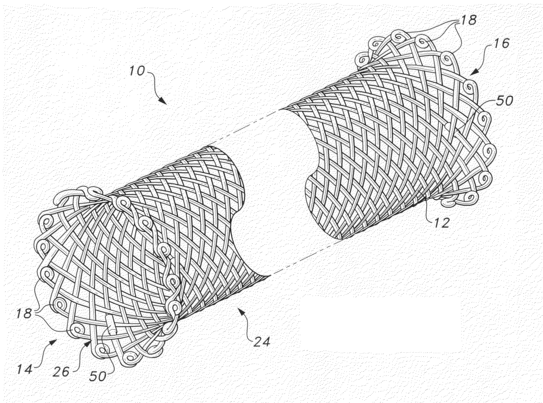 Self-expanding biodegradable stent