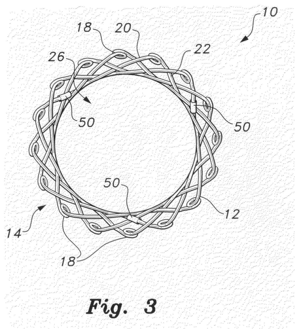 Self-expanding biodegradable stent