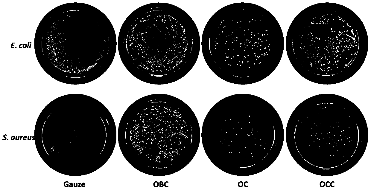 Local acute bleeding-stopping absorbable material and preparation method thereof